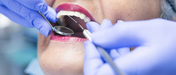 Best Emergency Gum Treatment in Reno, TX